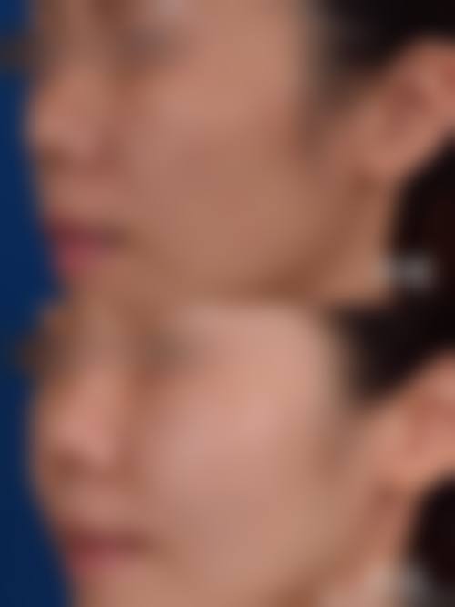 【谢洪彬医生技术特点】