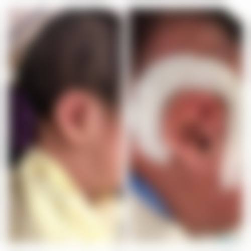 【四平贞媄兰积整形医院特色项目：】