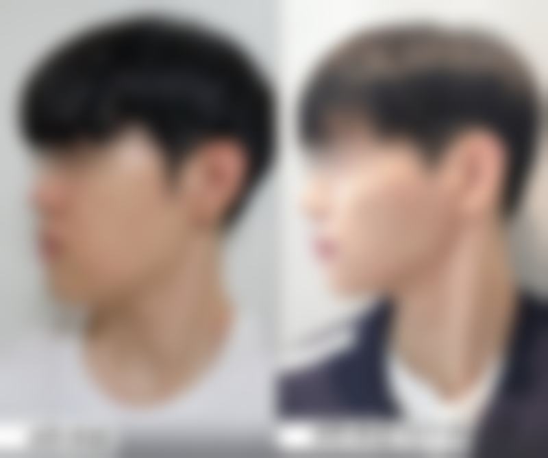 【韩国kcell皮肤科诊疗设备：】