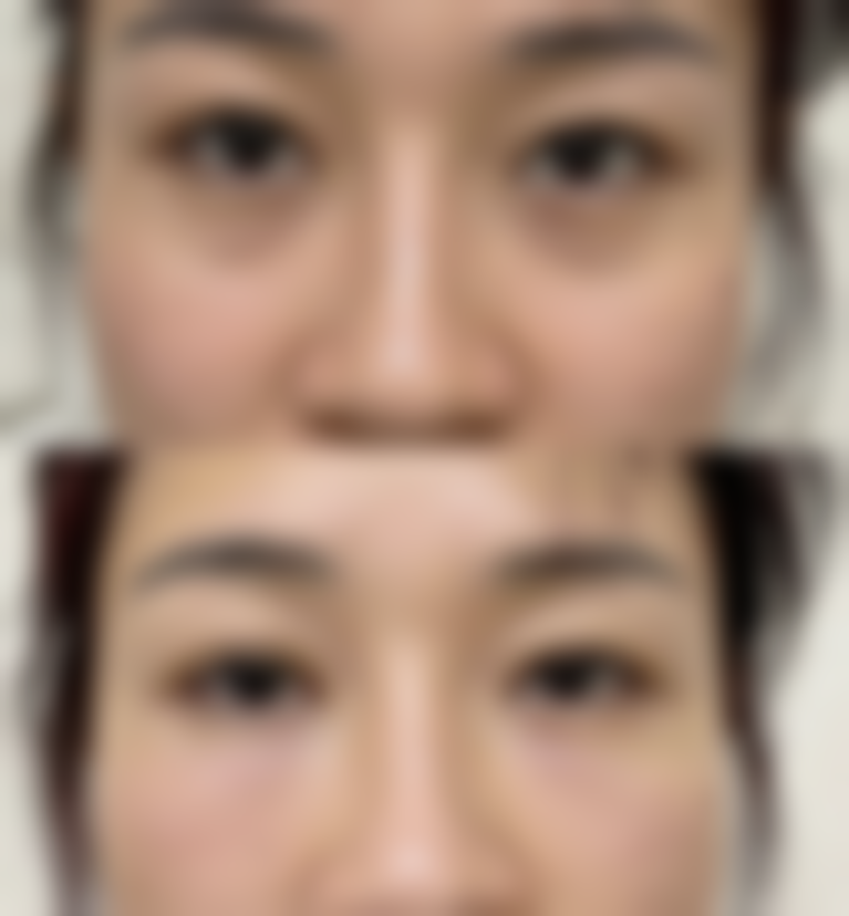 厚嘴唇变薄的小技巧