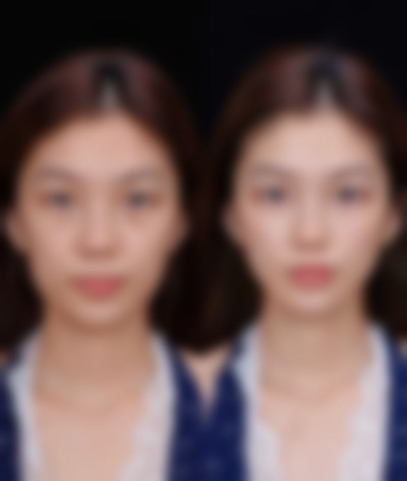 【郑州徐锐峰医疗美容诊所是正规的吗？】