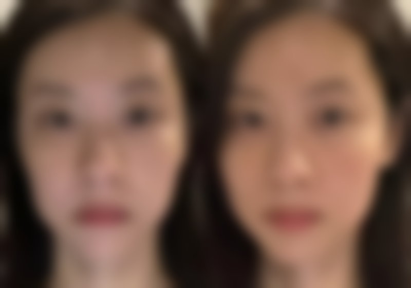 头发越来越少、吃中药能调理好吗