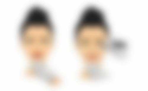 打瘦脸针多少钱