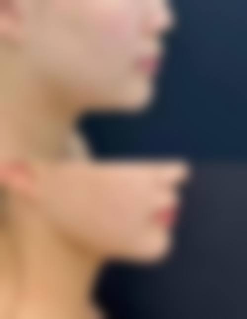 江苏常州多美（原博仕）医疗美容门诊部是一家正规的医美机构。它有着明确的医院地址，位于江苏省常州市钟楼区兰陵北路518号，并且具备开展医疗美容服务所需的相关资质和许可，能够为顾客提供安心、可靠的美容服务。