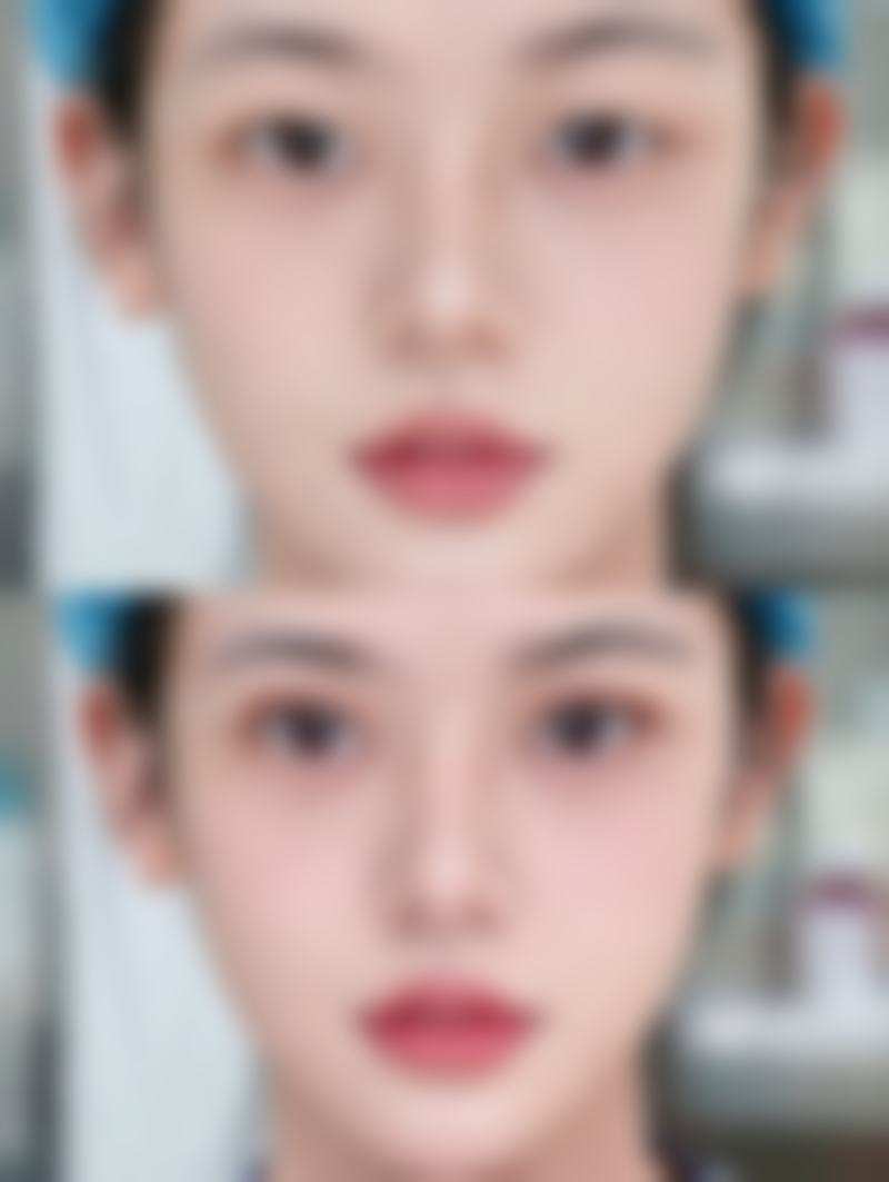 【南宁芯玥医疗美容是正规的吗?】