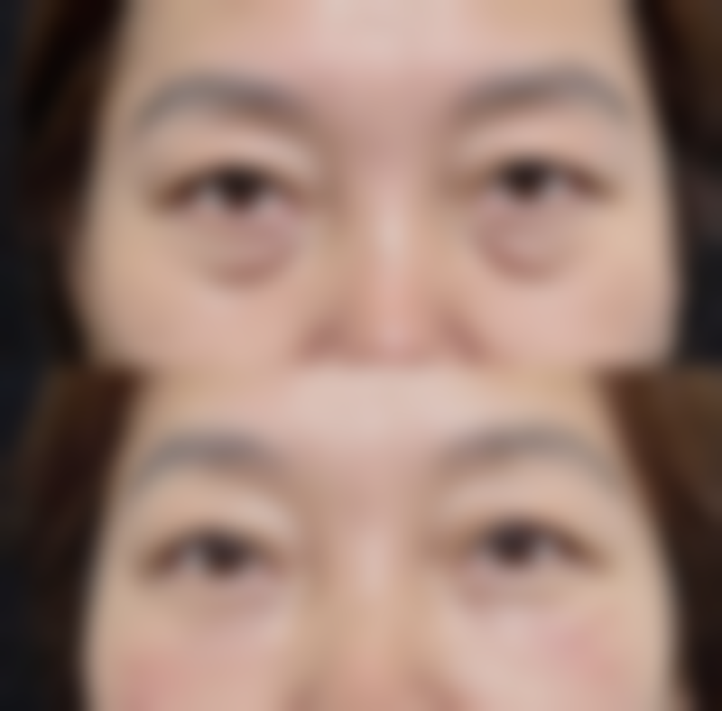 2. 我去做了韩式半恒久眉毛，工作人员都特别热情，医生的手法特别娴熟，做出来的眉毛自然又好看，非常适合我的脸型，以后还会再来的。