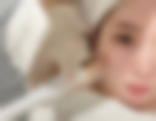 瘦脸针一般打50单位还是100单位