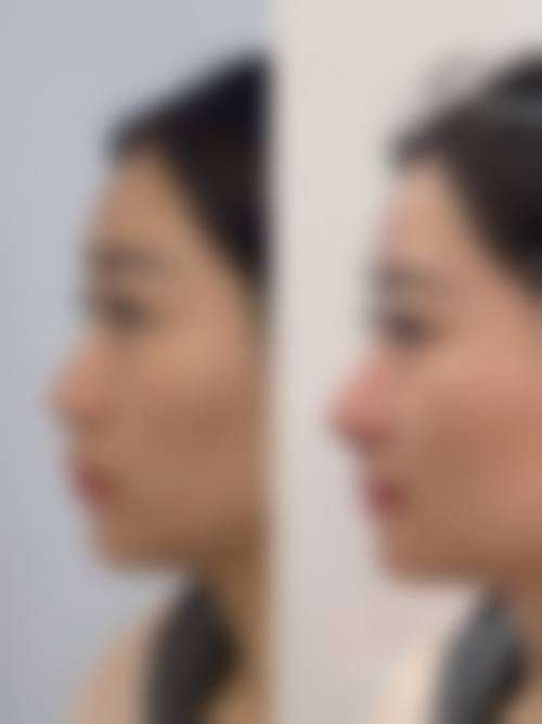 【杭州莱一美整形医院怎么预约挂号?】