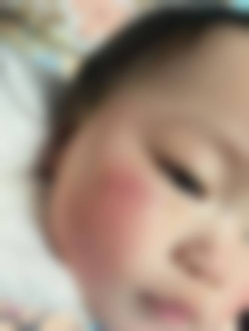 【赵娟医生口碑评价】