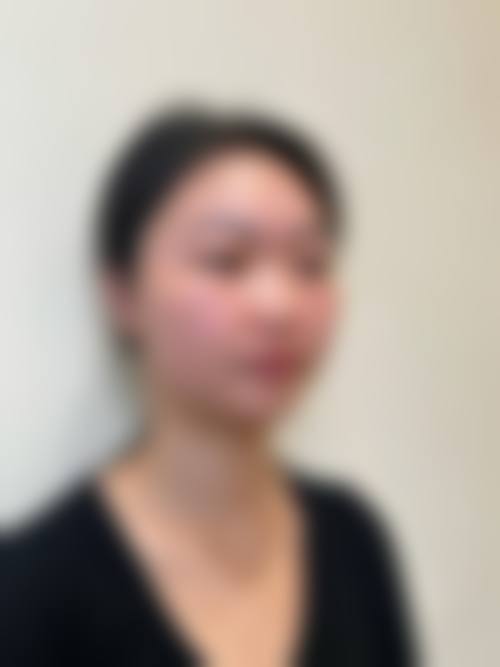 【赵娟医生擅长项目】