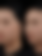 【南宁容颜医疗美容诊所特色项目：】