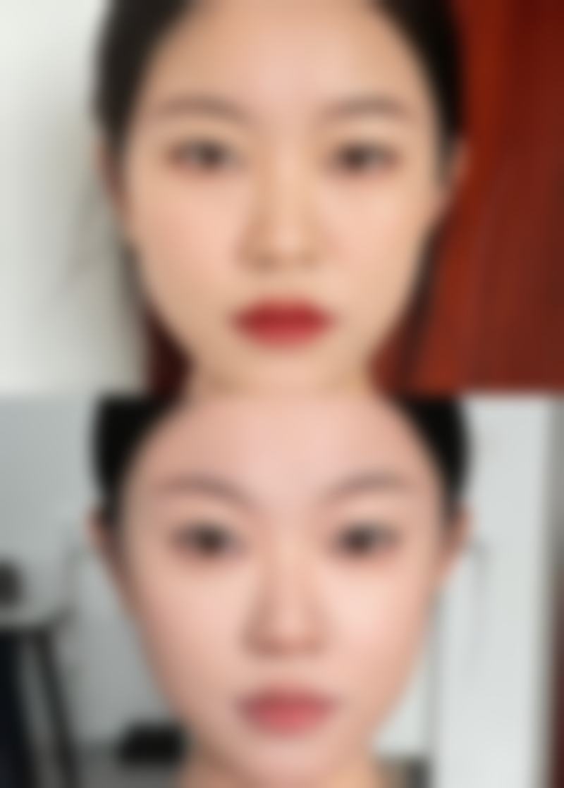 瘦脸针打一次维持多久