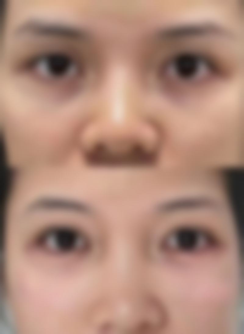 【郑京在医生技术特点：】