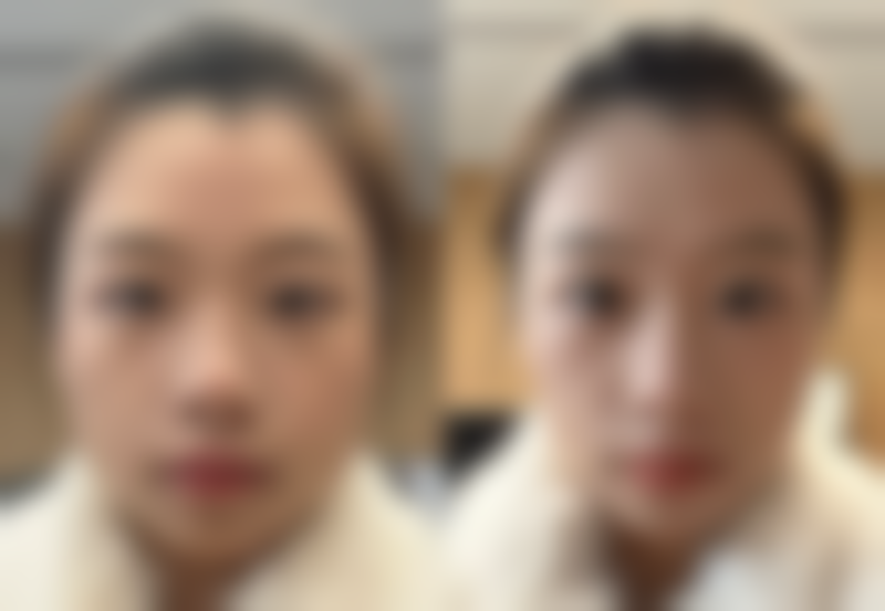 【深圳莱斯黛医疗美容门诊部是正规的吗?】