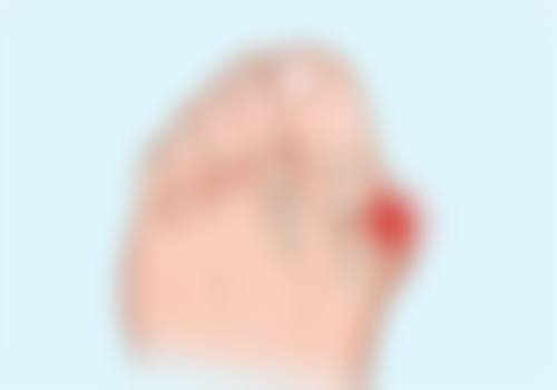 嘴唇有点厚怎么变薄了