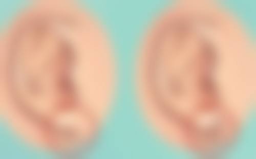 植发手术实例分享