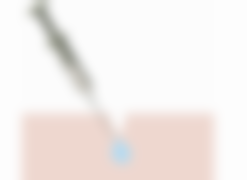 植发价格与注意事项