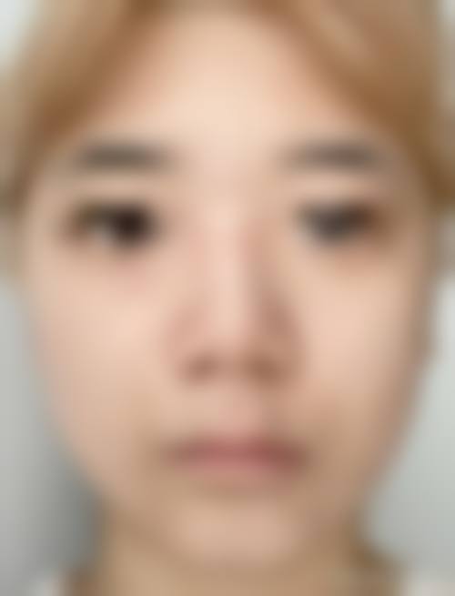 【杨庆培医生怎么预约挂号？】