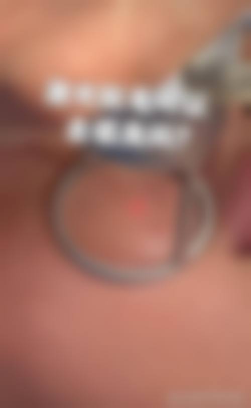 【杨士常医生怎么预约挂号?】