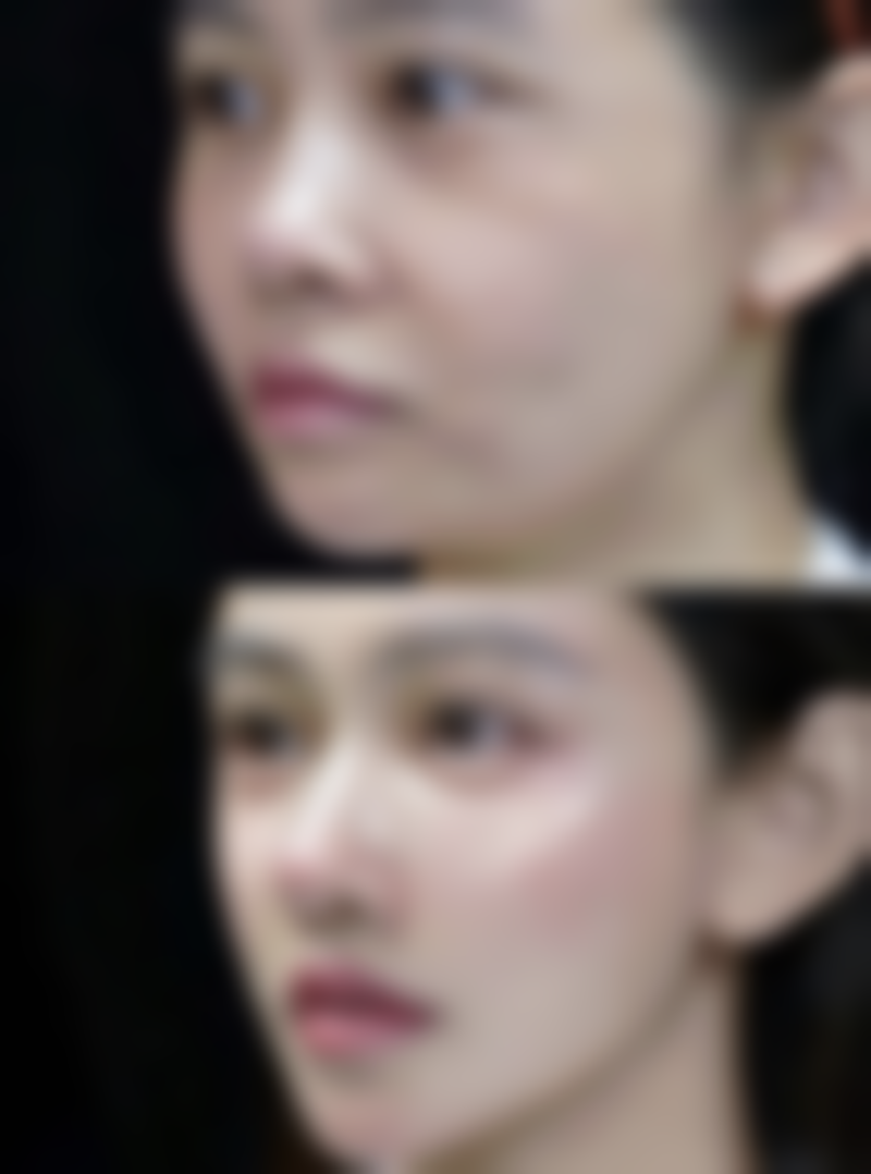 嘴唇厚怎么变薄知乎