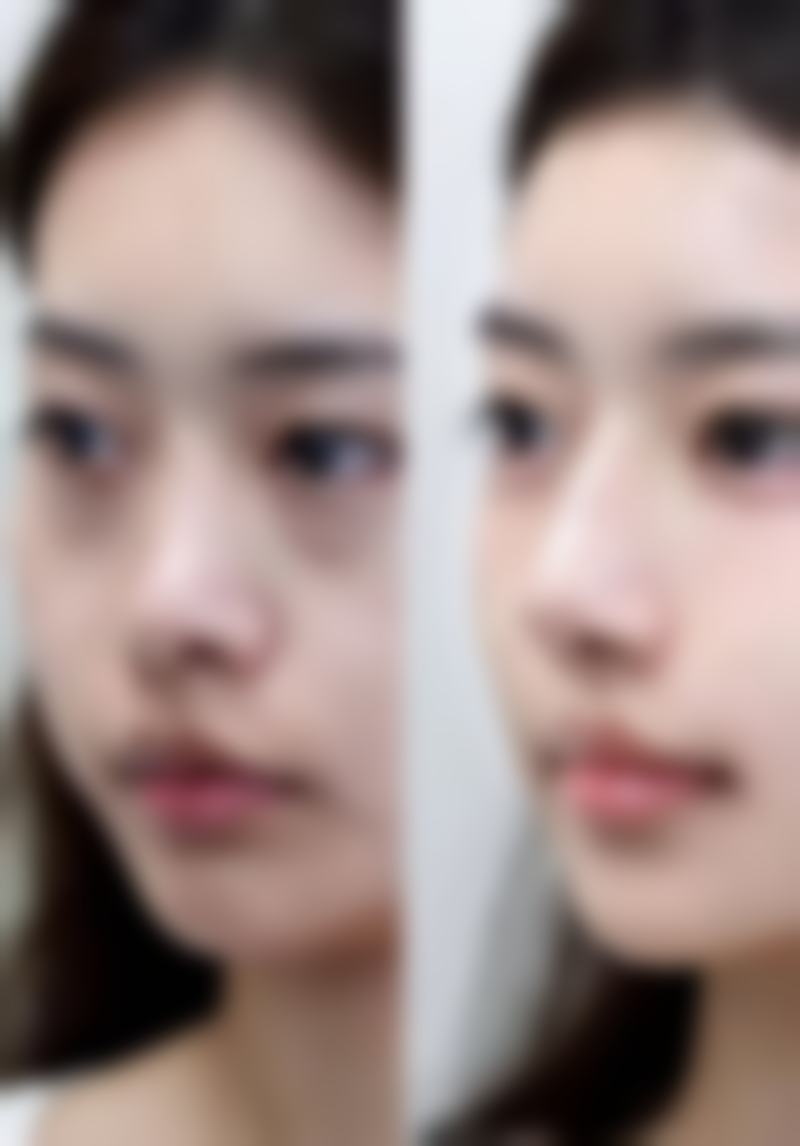 【重庆开州薇雅医疗美容特色项目：】