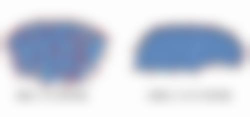 打完瘦脸针正确的睡姿