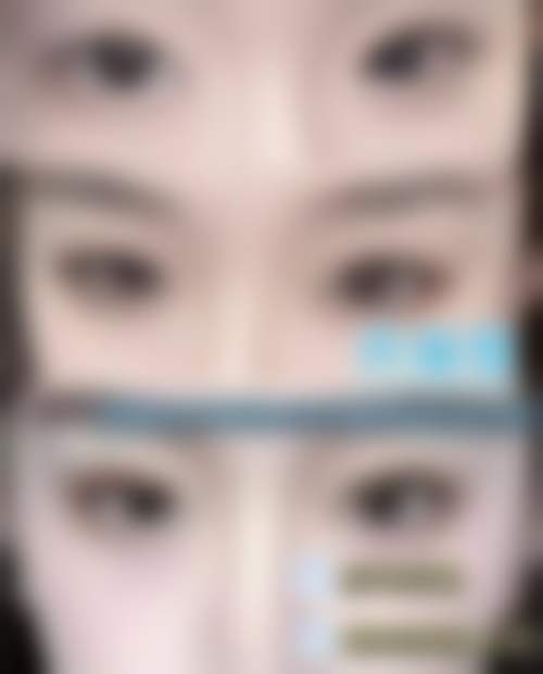 【詹艳伟医生荣誉资质】