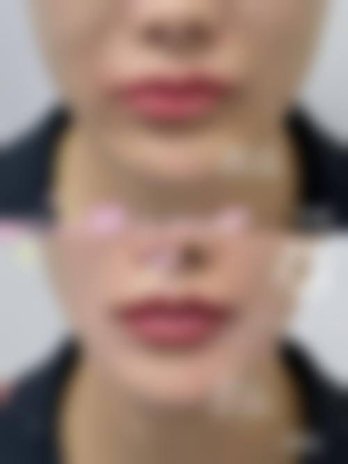 【福州蔻蔻的秘密医疗美容诊所核心优势:】