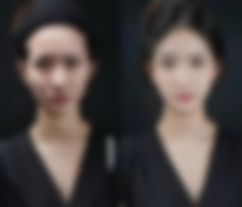 【长沙市开福区星雅医疗美容门诊部是正规的吗?】