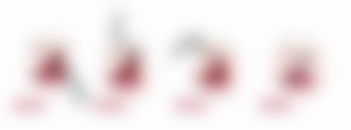 阴唇缩小手术的流程和注意事项