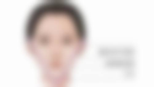 阴道紧缩术采用的是是什么方式?揭秘常见3种方式及优势，助你重拾紧致与自信！ 