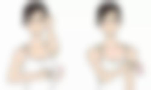 种植发际线多久能长全？了解3 - 6个月的关键生长期及后续效果，让你轻松拥有自然完美发际线！ 