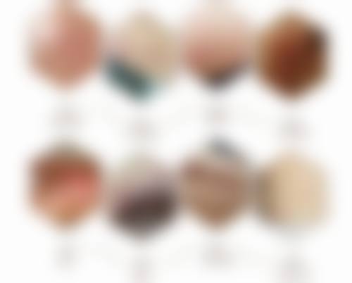 种植发际线需要多少钱