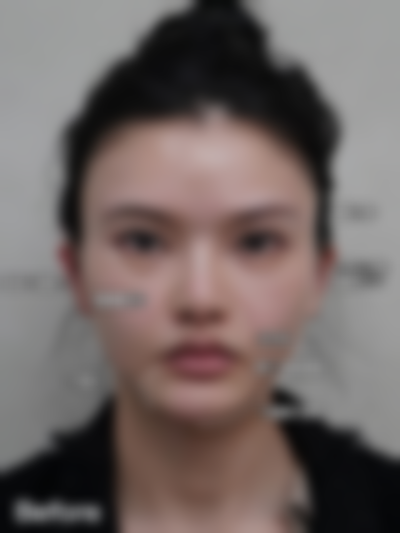 【陈天杰医生擅长项目】