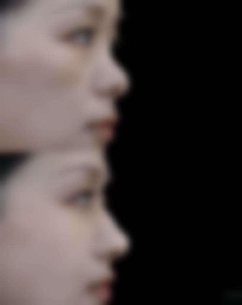 【北京雅韵整形医院患者口碑评价：】