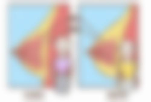 下颚歪斜怎么矫正？掌握这5种医美矫正方法，让你告别面部不对称，重塑精致脸型！ 