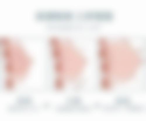 选择正规机构和专精医生的重要性