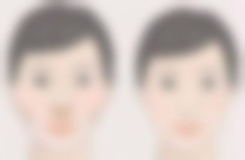 丰太阳穴可能出现的风险