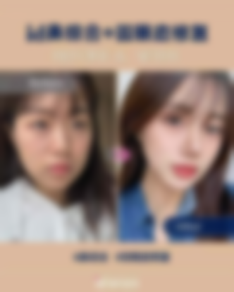 瘦脸针的危害和副作用