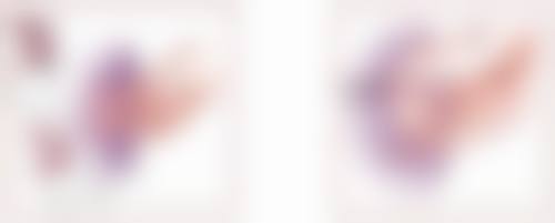 国字脸打瘦脸针可以变成瓜子脸吗