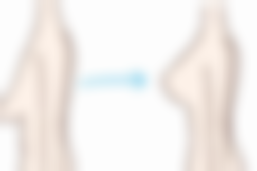 使用除皱针的注意事项