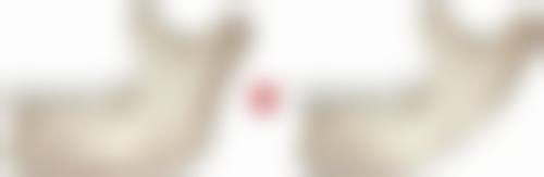 常见的除皱针品牌