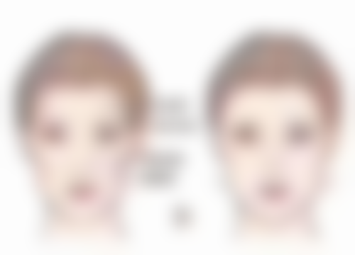 儿童嘴唇裂口小妙招