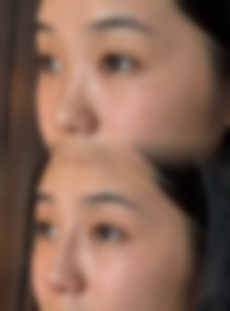 儿童嘴唇发红什么原因