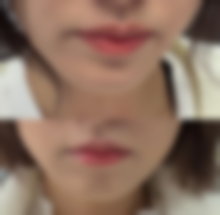 【重庆联合丽格美容整形医院患者口碑评价:】