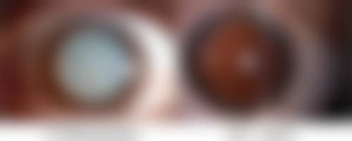 头发种植怎么做，方法和步骤大揭秘