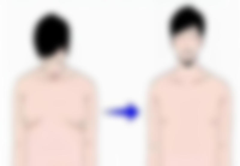 打瘦脸针多久可以吃辣椒?