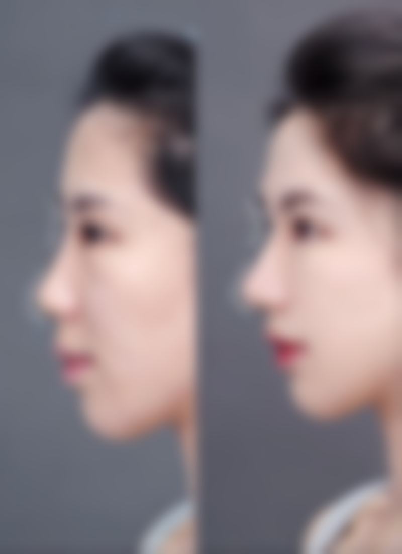 【温州华悦(皇佳)医疗美容门诊地址:】