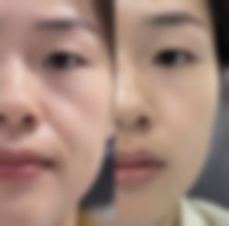 麻醉：减轻手术痛苦