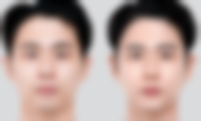 打瘦脸针能管多久